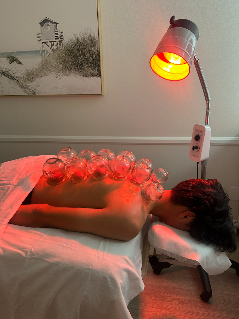 Fire cupping under a red light lamp in the treatment room
